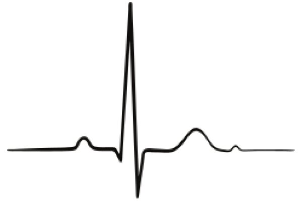 Simplistic ECG Line Graph on a White Background