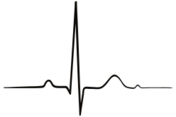 Simplified ECG Line Graph: A Visual Representation of Heart Rhythm