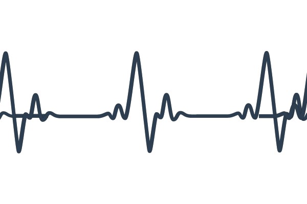Electrocardiogram (ECG) Signal