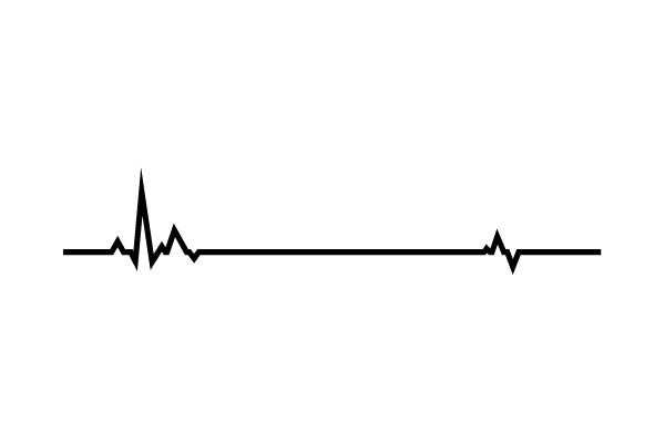 Baseline ECG Monitoring: Understanding Heartbeat Rhythms